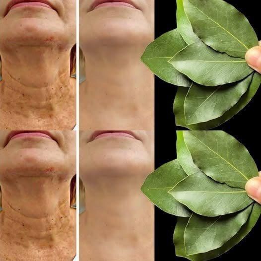 L'alloro è 100.000 volte più efficace del Botox? | Antirughe naturale anche a 70 anni!