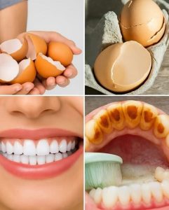Illumina il tuo sorriso in modo naturale con ingredienti da cucina