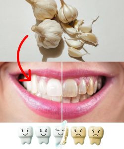 I dentisti rimarranno disgustati quando scoprirai che conosci questo trucco: come rimuovere velocemente il tartaro e sbiancare i denti a casa!