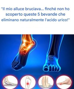 « Il mio alluce bruciava… finché non ho scoperto queste 5 bevande che eliminano naturalmente l’acido urico! »