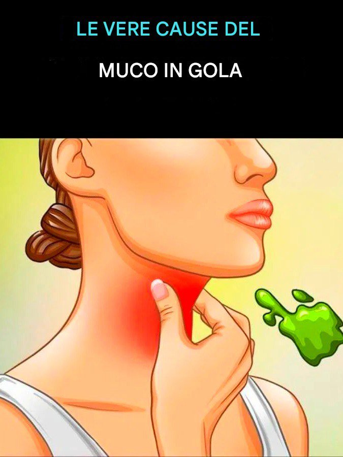Le vere cause del muco in gola e come liberarsene