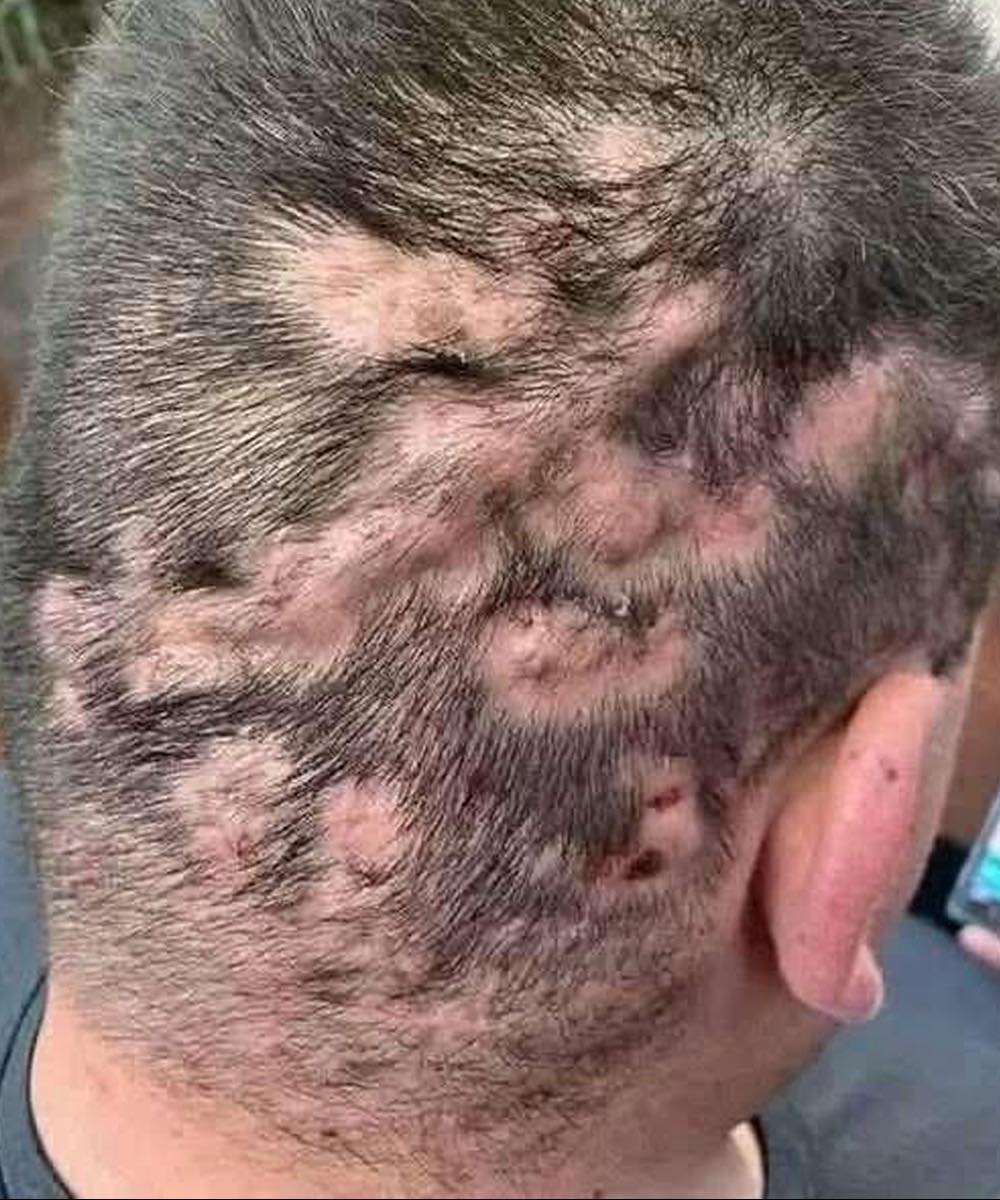 Questi sono i primi sintomi